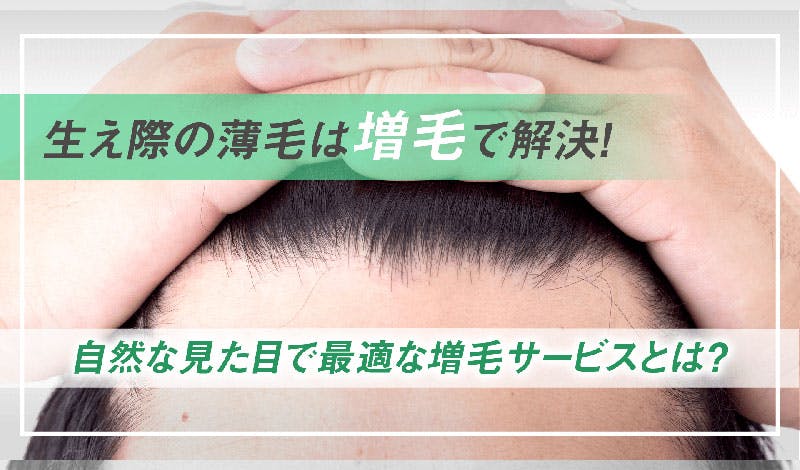 おでこの生え際の薄毛は増毛で解決 前髪が薄くなる原因は 髪コト 頭髪を通じてライフスタイルを豊かにするための情報を発信 おでこの生え際の薄毛は増毛で解決 前髪が薄くなる原因は 髪コト 頭髪を通じてライフスタイルを豊かにするための情報を発信