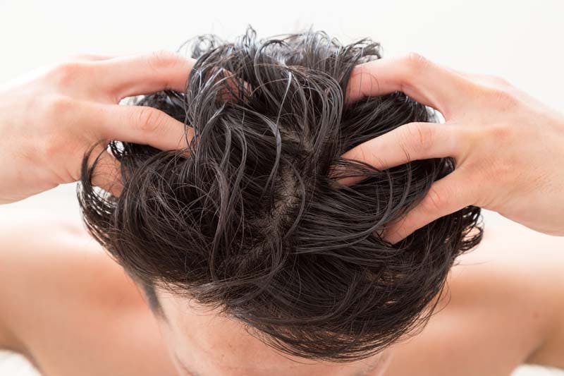 おでこの生え際の薄毛は増毛で解決 前髪が薄くなる原因は 髪コト 頭髪を通じてライフスタイルを豊かにするための情報を発信 おでこの生え際の薄毛は増毛で解決 前髪が薄くなる原因は 髪コト 頭髪を通じてライフスタイルを豊かにするための情報を発信