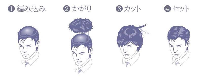 編み込み式増毛法の手順