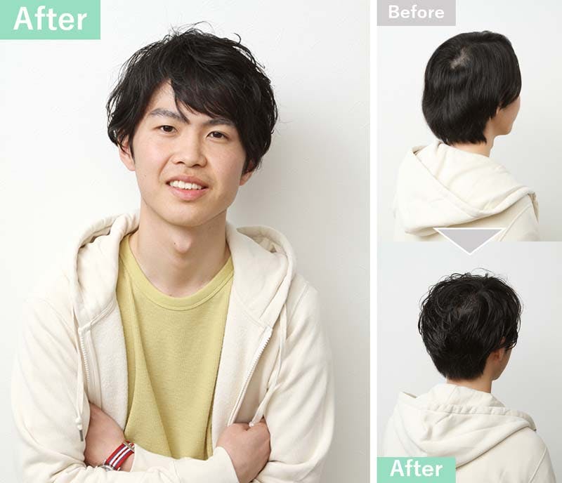 つむじ割れでお悩みの男性必見 6つの原因と対策 髪コト 頭髪を通じてライフスタイルを豊かにするための情報を発信