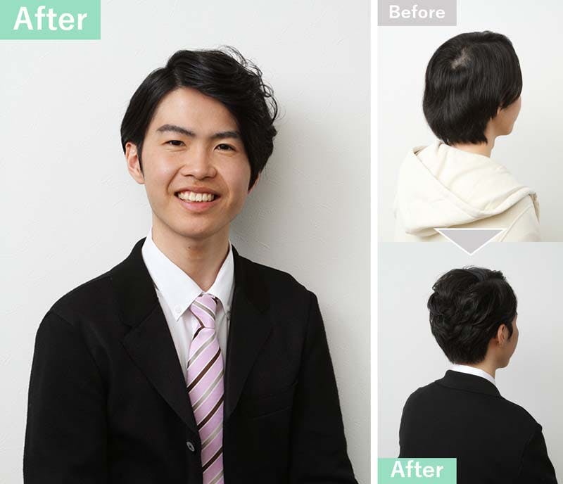 薄毛が目立たない七三分けのパーマスタイルにセットした実例