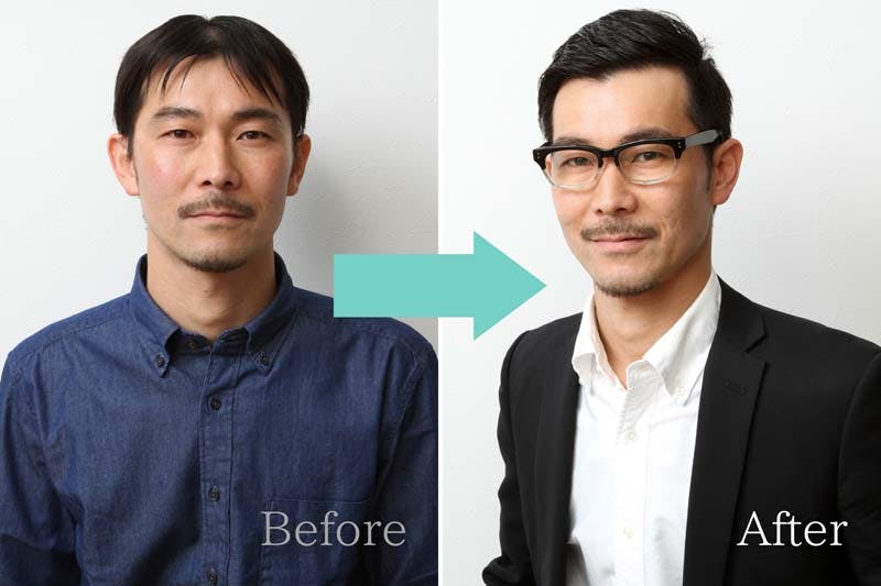 頭頂部が薄毛になる原因と改善方法 薄くなったつむじは増毛で対策を 髪コト 頭髪を通じてライフスタイルを豊かにするための情報を発信