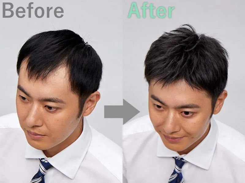 旦那がはげてきたらみんなどうしてるの 伝え方や薄毛対策を聞いてみた 髪コト 頭髪を通じてライフスタイルを豊かにするための情報を発信