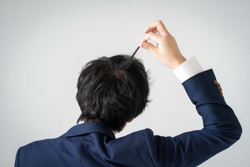 髪の毛を触って気にする男性のイメージ画像