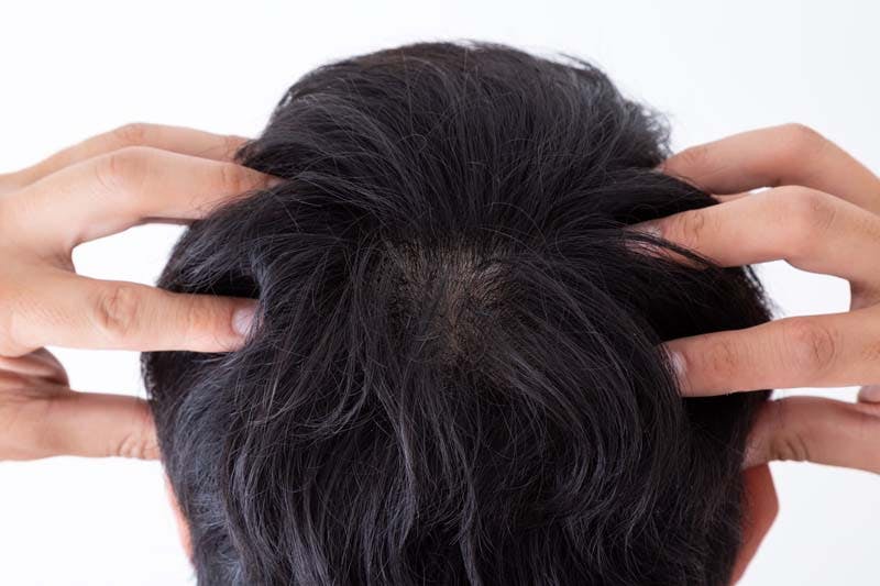 頭皮マッサージをする男性のイメージ画像