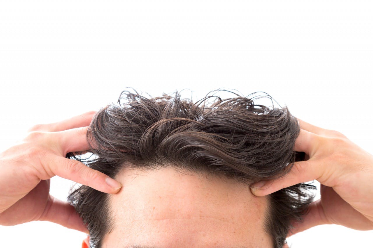 監修記事 M字ハゲってどういう状態のこと 原因や対処法を解説 髪コト 頭髪を通じてライフスタイルを豊かにするための情報を発信