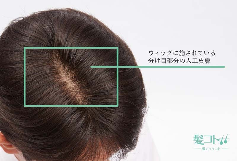 分け目部分に人工皮膚が施されているウィッグの例