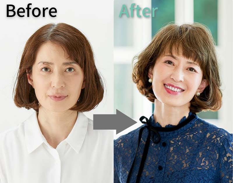 レディススヴェンソンのカツラ(ウィッグ)を装着した女性のビフォーアフター画像