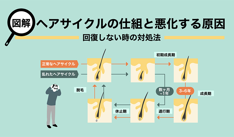 図解】ヘアサイクルの仕組みと悪化する理由～回復しないときの対処法 | 抜け毛・薄毛のお悩み