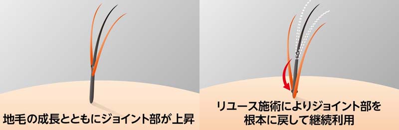 将来禿げる sddefault.jpg