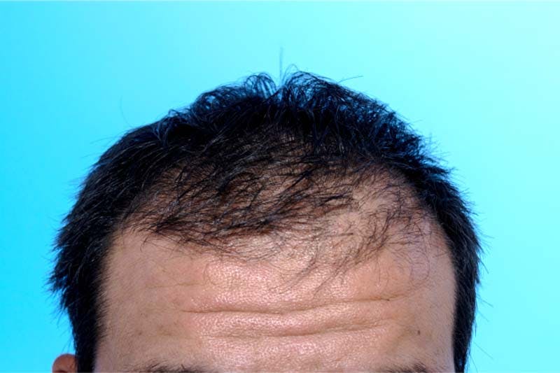 男性向け 髪の毛を太くする4つの方法とは 細くなってきたら要注意 髪コト 頭髪を通じてライフスタイルを豊かにするための情報を発信 男性向け 髪の毛を太くする4つの方法とは 細くなってきたら要注意 髪コト 頭髪を通じてライフスタイルを豊かにするための情報を発信