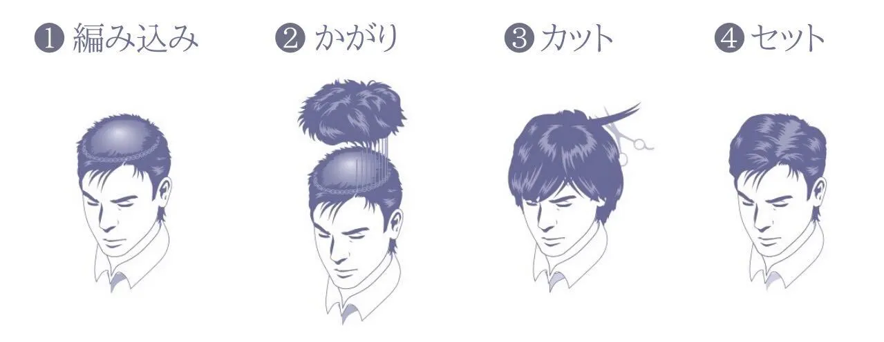 監修記事 M字ハゲってどういう状態のこと 原因や対処法を解説 髪コト 頭髪を通じてライフスタイルを豊かにするための情報を発信