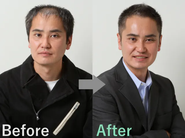 薄毛対策 男性におすすめの髪の抜け毛予防 防止対策を解説 髪コト 頭髪を通じてライフスタイルを豊かにするための情報を発信