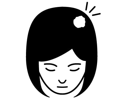 円形脱毛症のイラスト画像