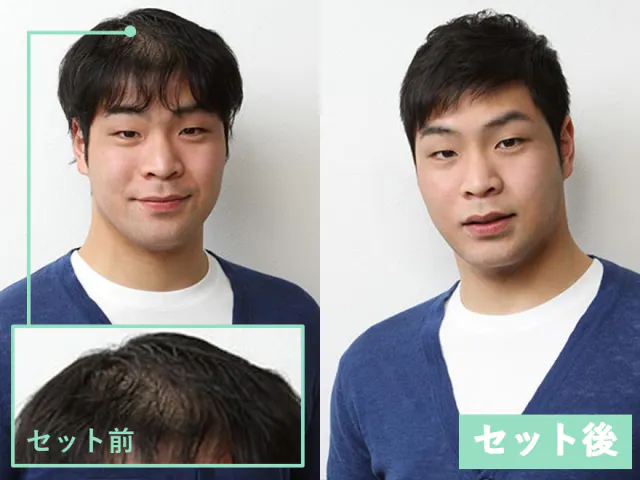 薄毛の男性は結婚対象になる はげの印象って 女性0人に調査 髪コト 頭髪を通じてライフスタイルを豊かにするための情報を発信