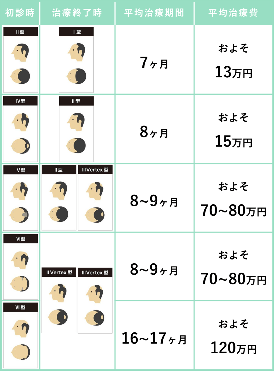 ハミルトン・ノーウッド分類の類型別にAGAの治療期間を示した説明イラスト