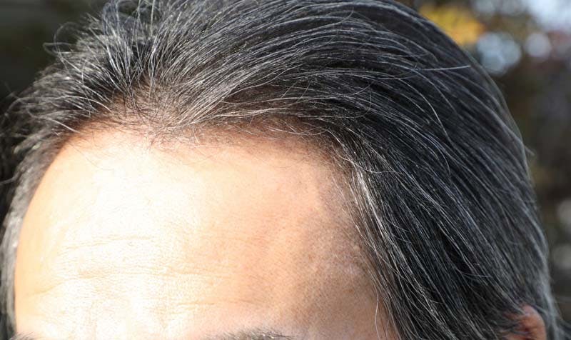 白髪が混じった男性の生え際のイメージ画像