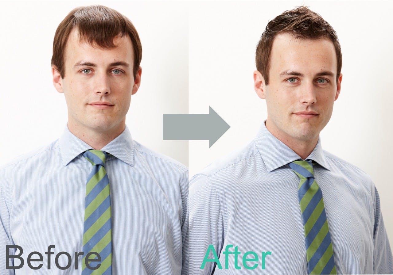 薄毛専門美容室でヘアカットをした男性の「M字はげ」ビフォーアフター