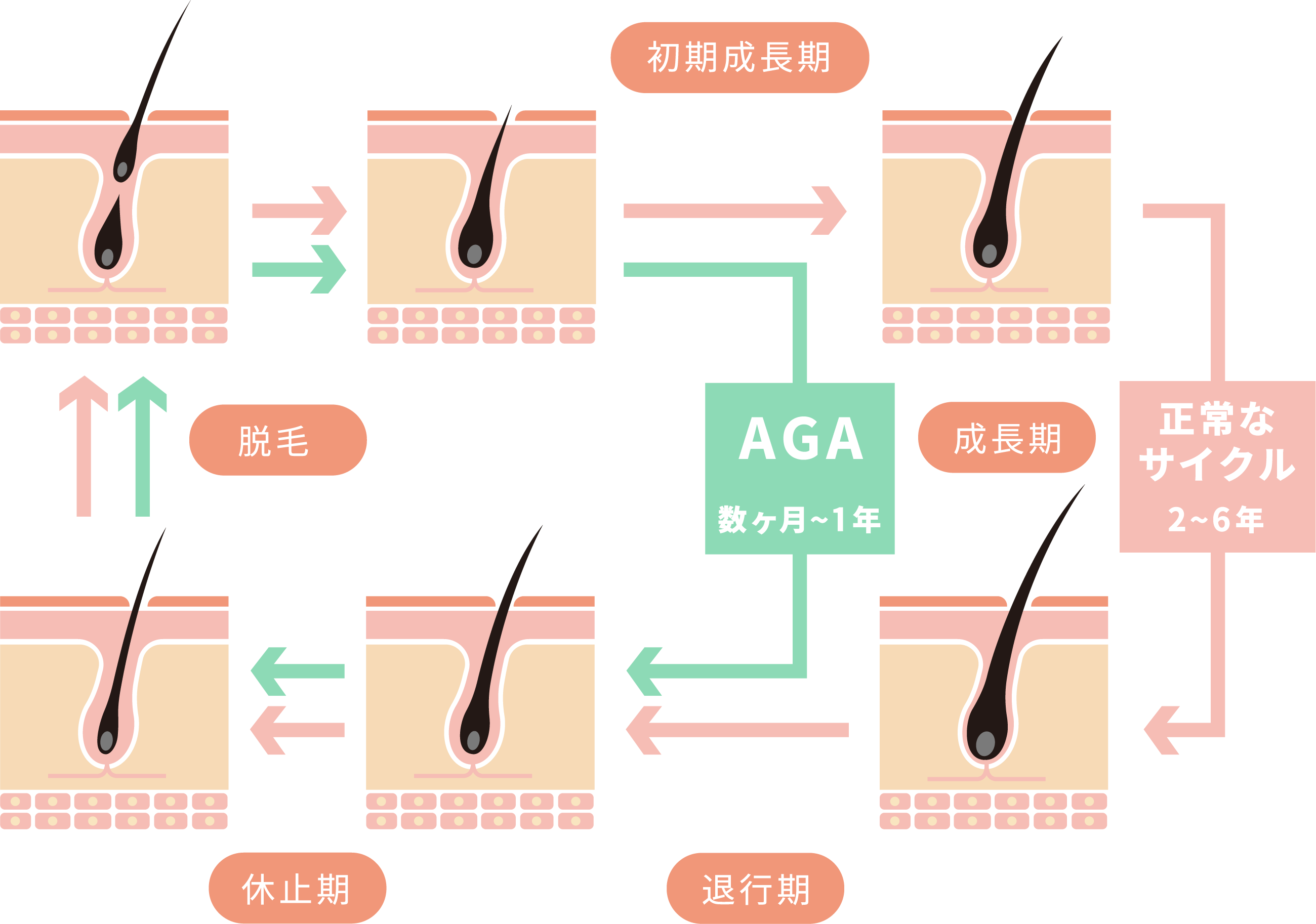 医師監修 その薄毛諦めてませんか つむじの薄毛を今日で解消 髪コト 頭髪を通じてライフスタイルを豊かにするための情報を発信