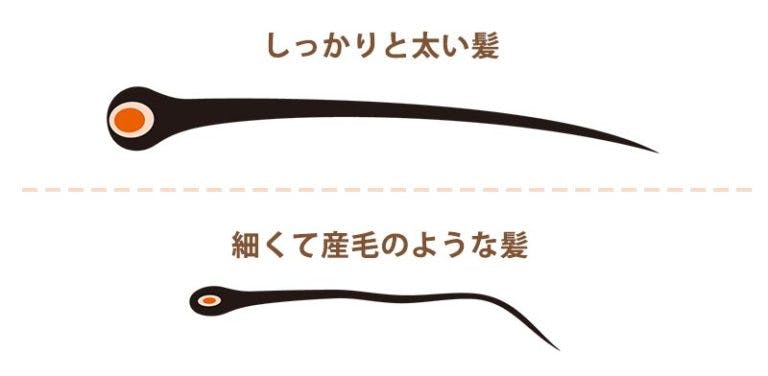 しっかりと太い髪、細くて産毛のような髪の比較イラスト