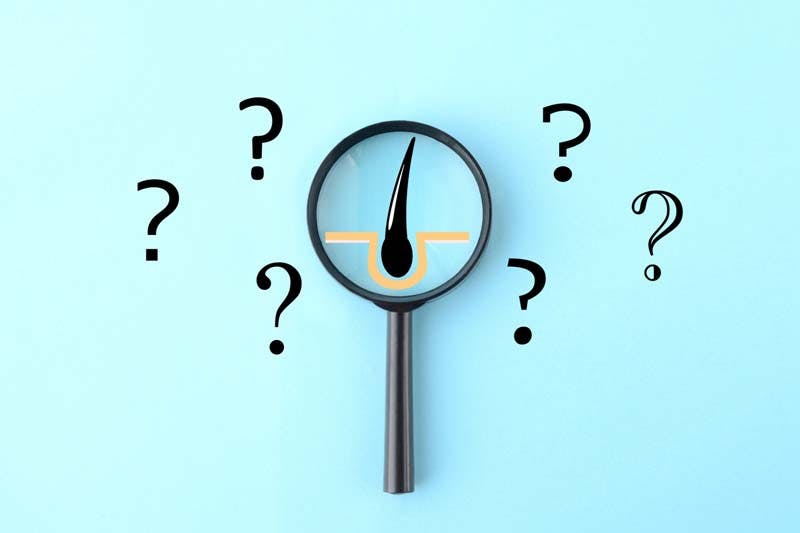 5αリダクターゼについての疑問のイメージ画像