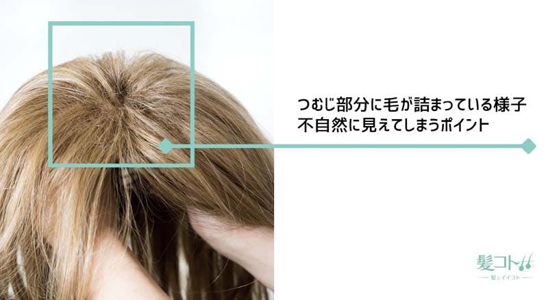 人工皮膚が施されていないかつら（ウィッグ）のつむじ部分。つむじ部分に毛が詰まって不自然に見えてしまう