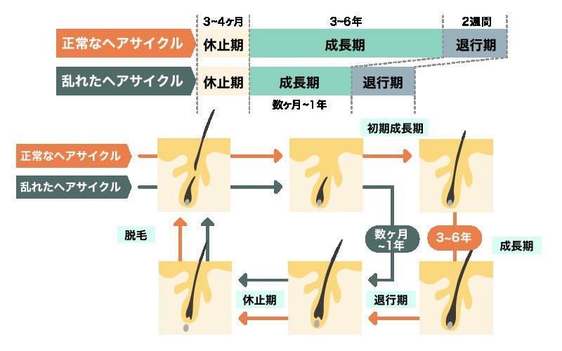 正常なヘアサイクルと乱れたヘアサイクルを比べたイラスト