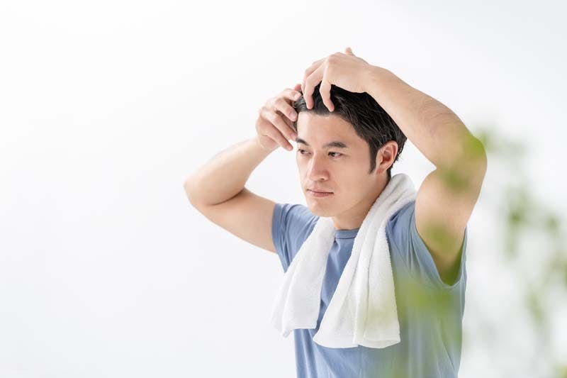 M字ハゲを気にする男性の画像