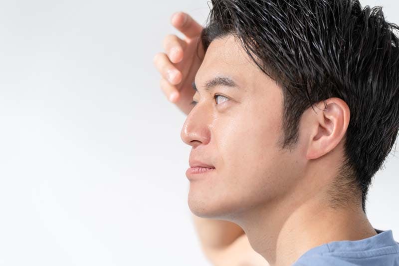 フィナステリドの効果を期待している男性の画像