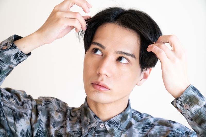 ハゲを気にする10代男性の画像