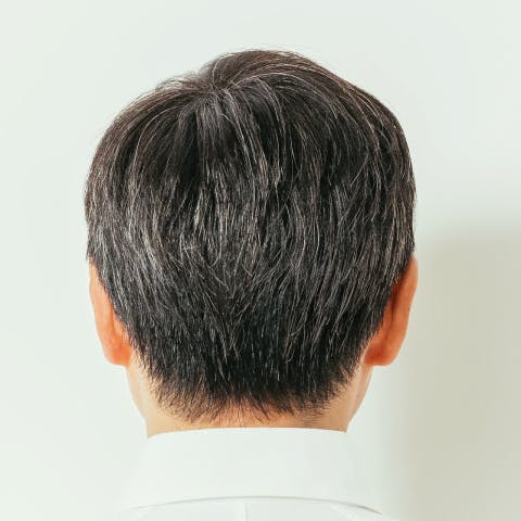 After Back