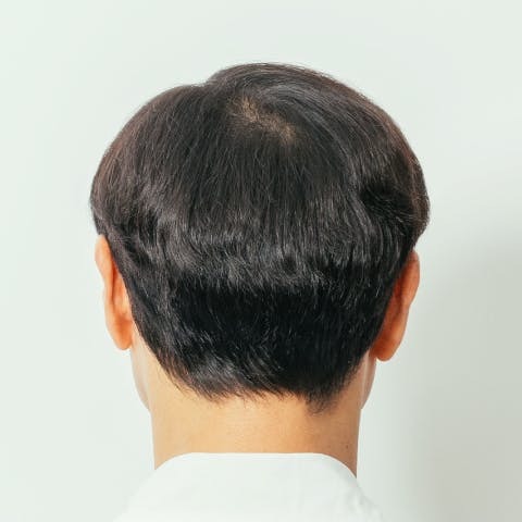 Before Back