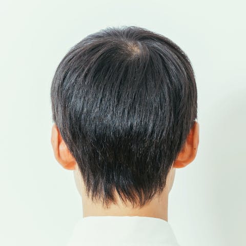 Before Back