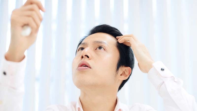 抜け毛をチェックする男性