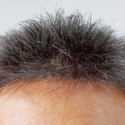 Hairline Premier