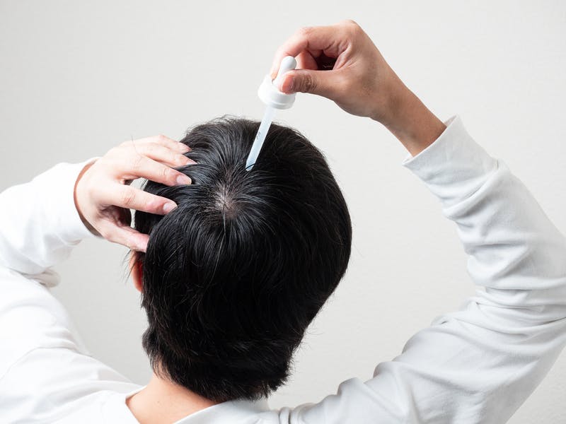 頭頂部に育毛剤を使う男性の背面ショット