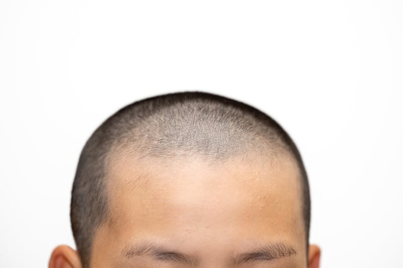 坊主頭に整えた男性の頭部のアップ