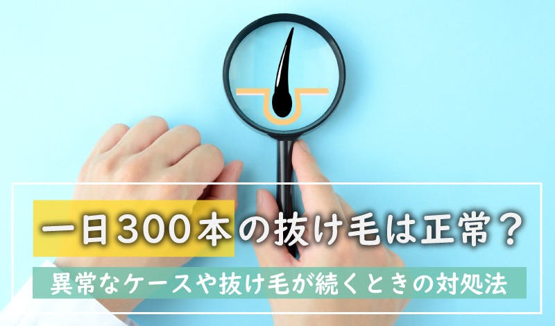 抜け毛 一日 300本