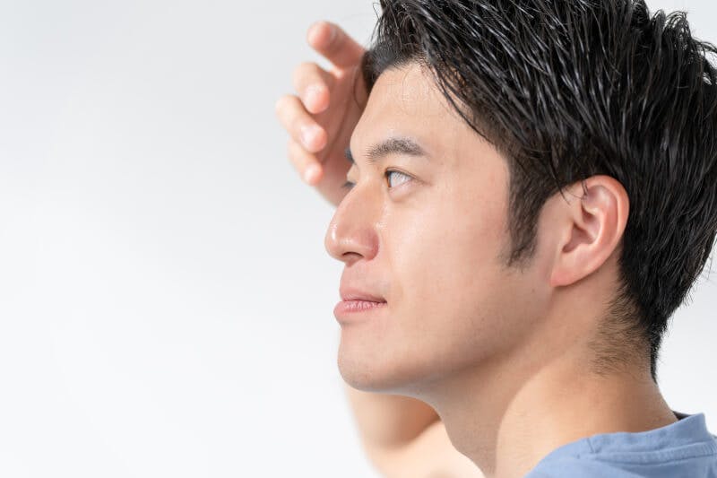 生え際を気にする男性