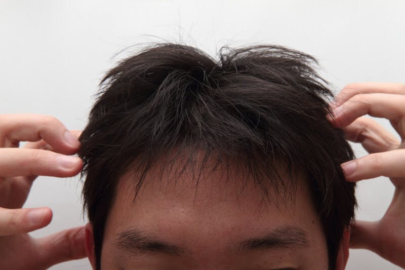 頭を抱える男性