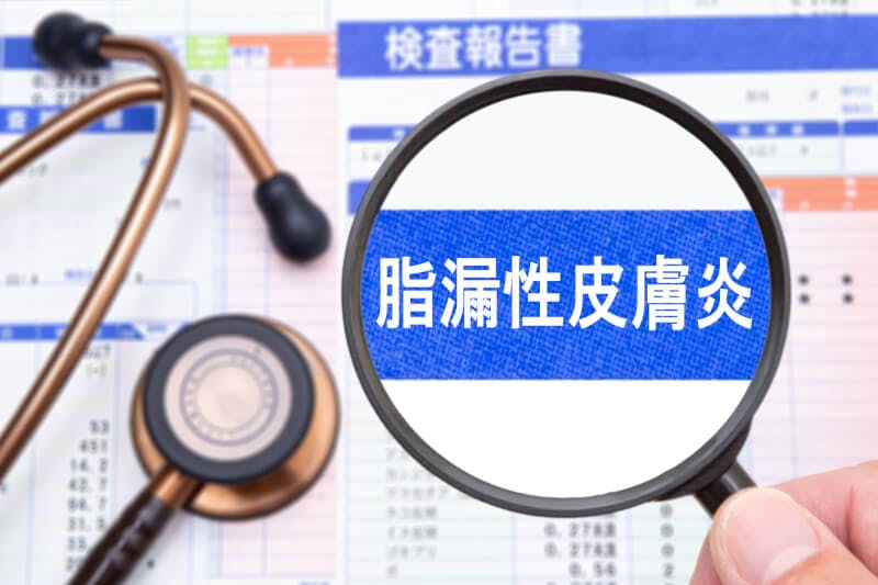 拡大鏡で見る脂漏性皮膚炎の文字