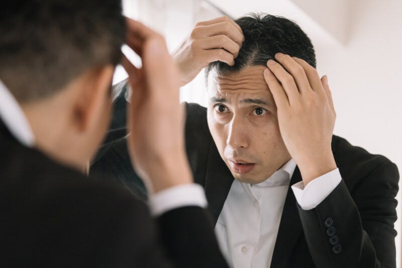 額の髪の生え際を気にする50代の男性