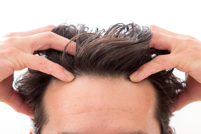 頭皮ケアをする男性の額