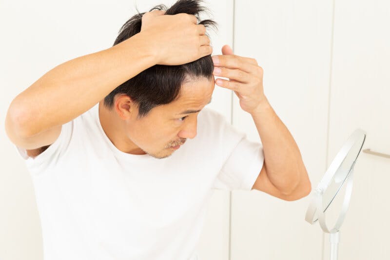 前髪をあげて額の広さと生え際をチェックする男性