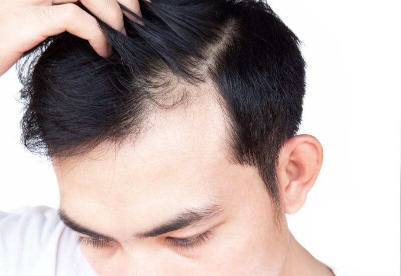 生え際の様子をチェックしている男性の様子