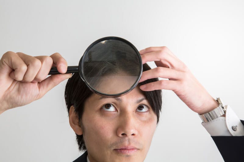 虫眼鏡を使って自分の頭頂部を確認している男性