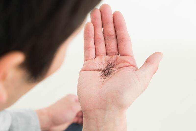 手についた抜け毛を見る男性の後ろ姿