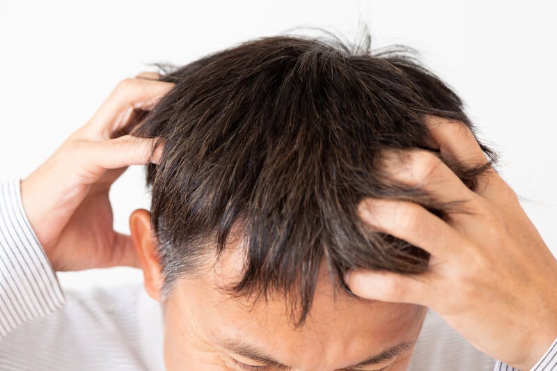 頭皮を指圧している男性