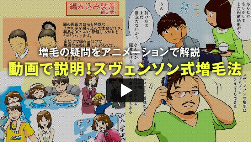動画で説明!スヴェンソン式増毛法