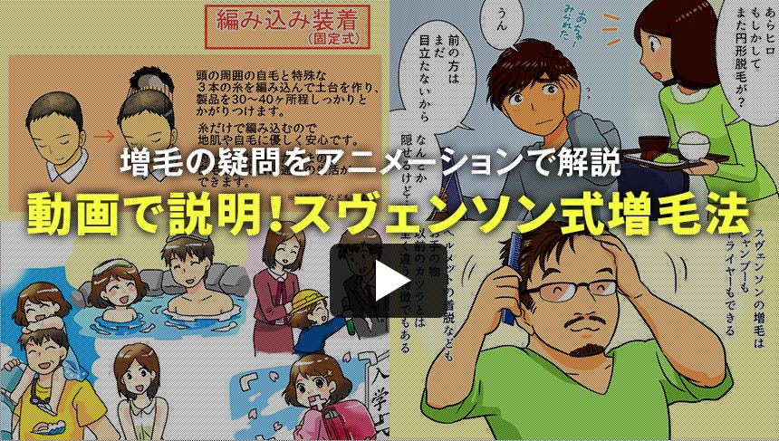 動画で説明！スヴェンソン式増毛法